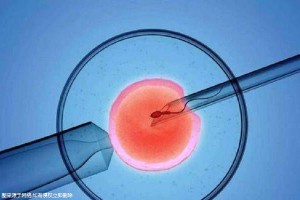 关于靠谱试管代孕机构